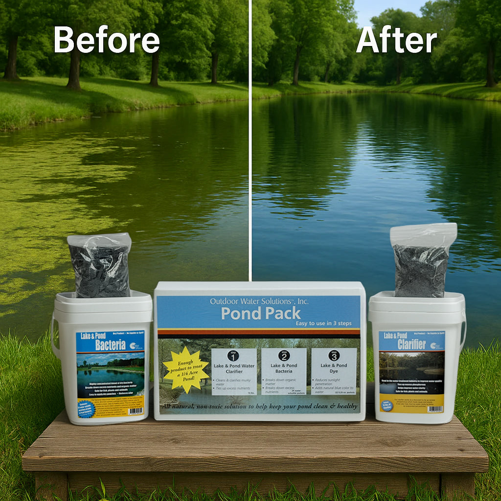 Pond Pack - Pond Treatment Bundle